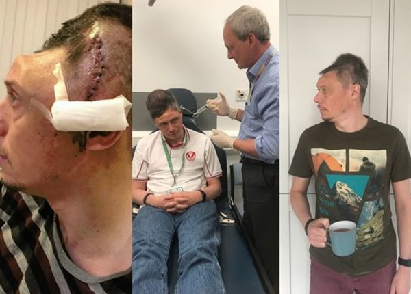 A craniotomy – ‘the last resort’