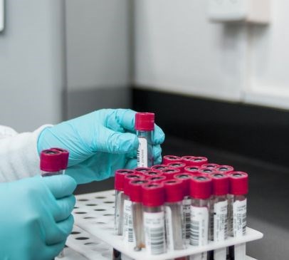 S100B as potential diagnostic marker for SRC protocols Main Image