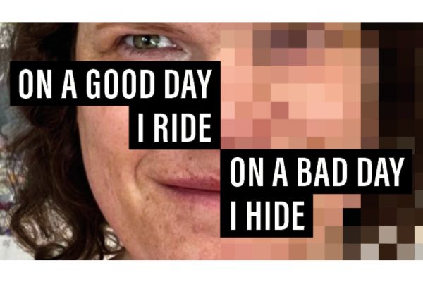 Lorna's story On a good day