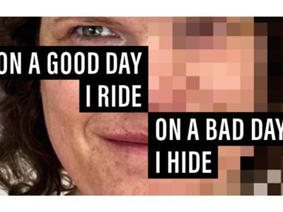 Lorna's story On a good day