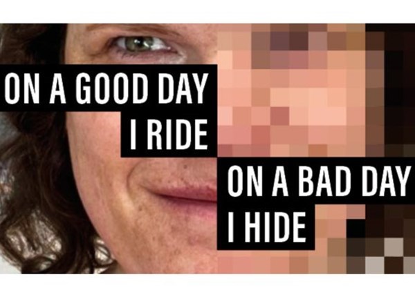 Lorna's story On a good day
