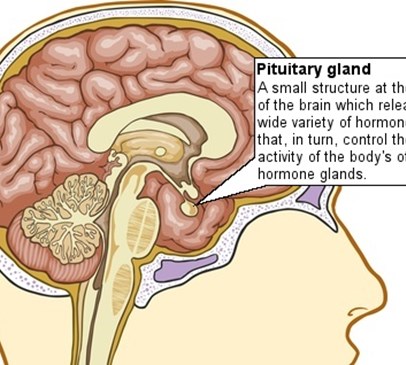 Hypopituitarism following traumatic brain injury (1) Main Image