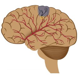 Mapping the way to recovery Main Image