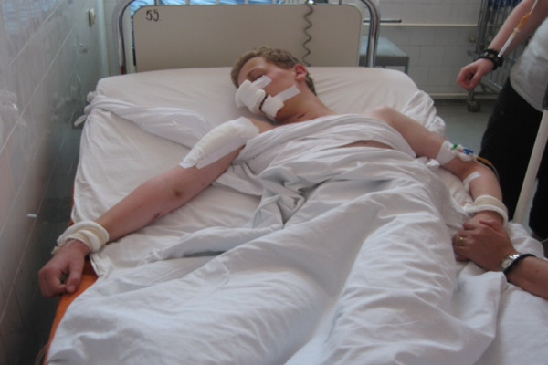 Peter spent 10 days in a coma following his brain injury