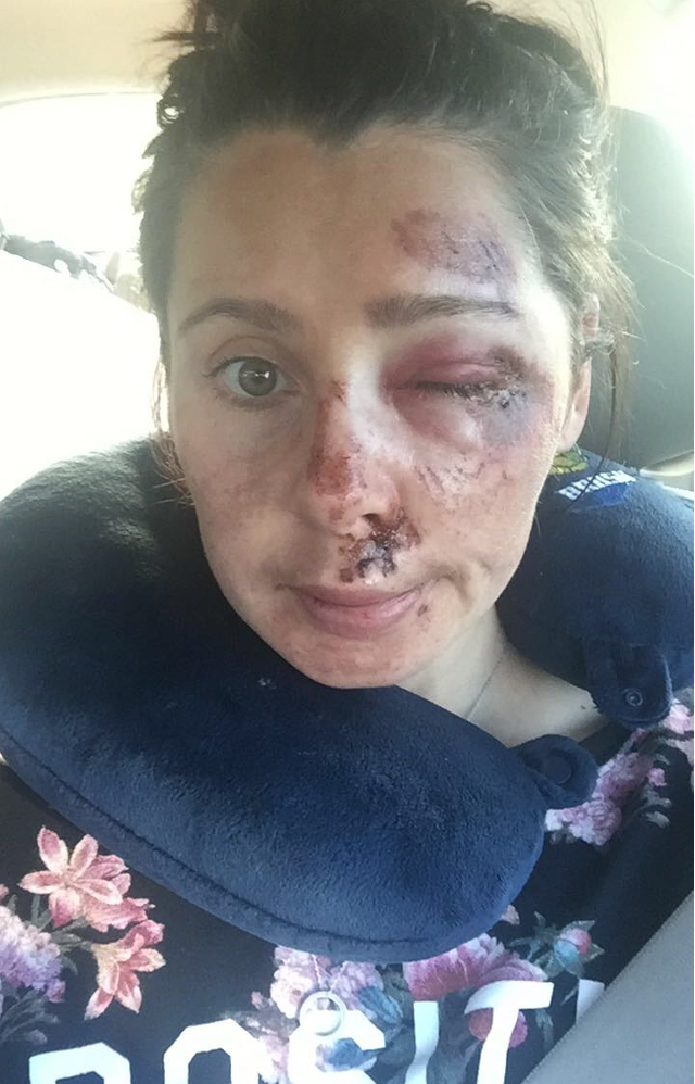 Nikki was injured at the European Cyclo Cross Champs in 2016