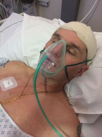Terry after the operation that saved him after his burst brain aneurysm