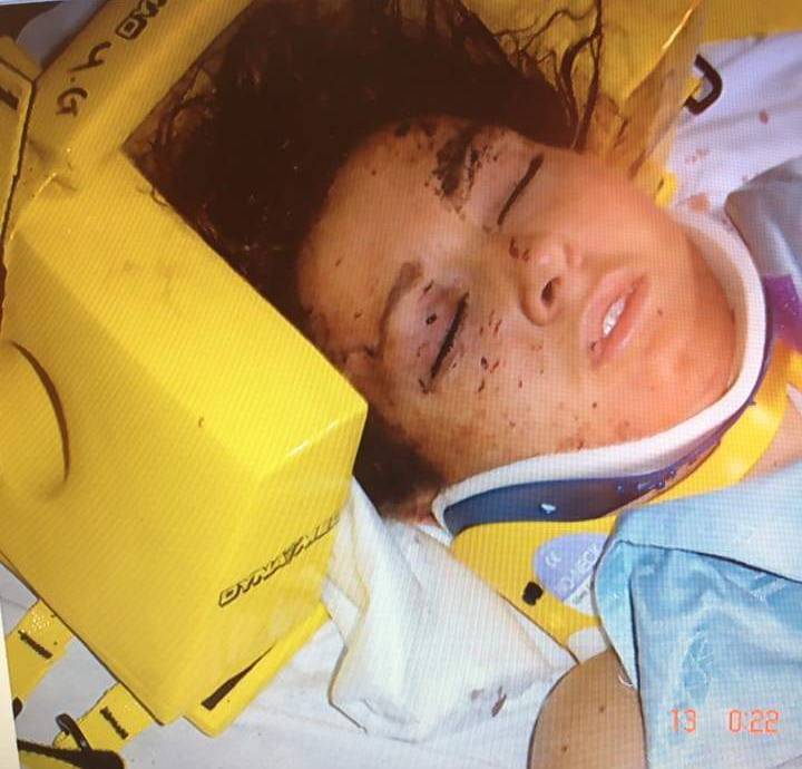 Rebecca in hospital following the accident