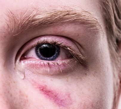 Domestic Abuse Bill debate highlights extent of brain injury among victims of domestic violence Main Image