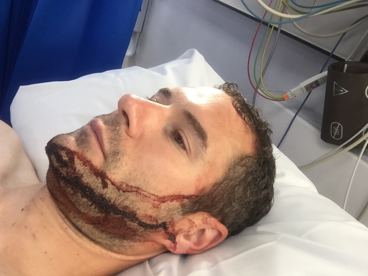 David was rushed to hospital and told the life-changing news that he had sustained a traumatic brain injury