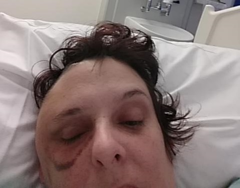Donna in hospital
