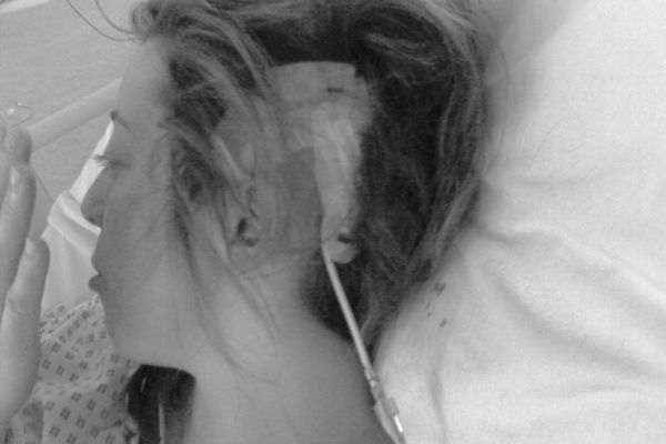 Claire in hospital, a week after surgery.